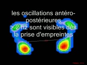 empreinte sup a 2hz neuro.wmv