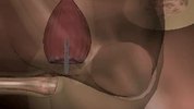 cupule_et_cils