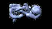 oreille_interne_irm