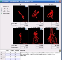 Triceps sural exercice