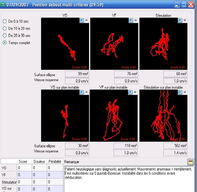 Analyse Hexa-séquentielle, sur plate-forme stable puis instable amortie.