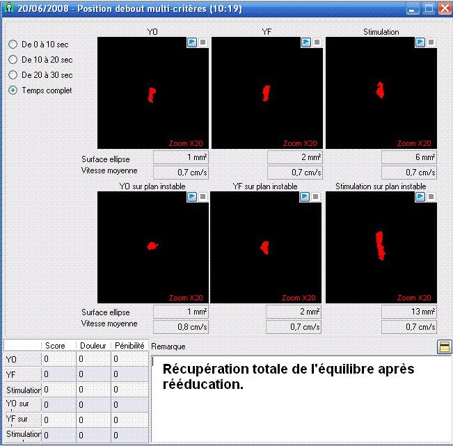 Analyse Hexa-séquentielle, sur plate-forme stable puis instable amortie.