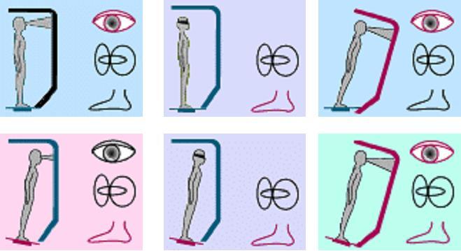 Posturographie dynamique en rééducation vestibulaire - Computerized ...